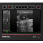 PREGNANCY SCANNER – DRAMINSKI ISCAN 2 MULTI - Image 6