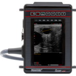 PREGNANCY SCANNER – ISCAN MINI - Image 3