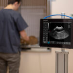 PREGNANCY SCANNER – ISCAN BLUE - Image 2