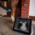 PREGNANCY SCANNER – ISCAN BLUE - Image 3